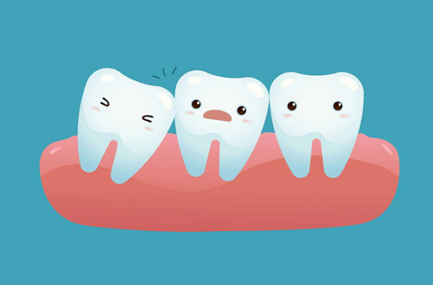 Can I Wear Retainers After Wisdom Teeth Removal